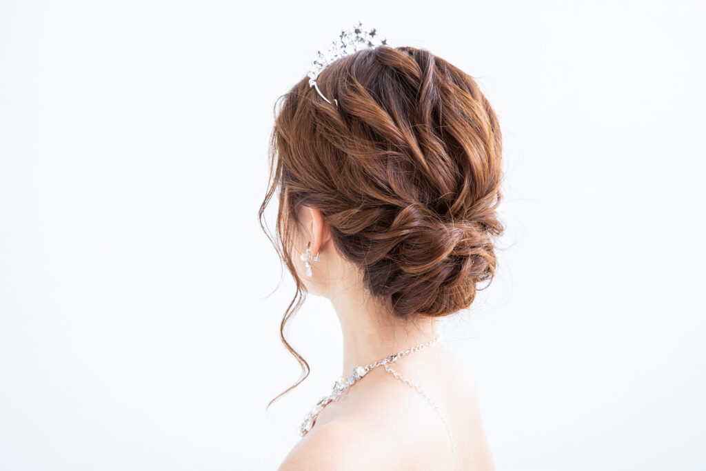 ブライダル矯正の期間は？種類と時期別おすすめプランを解説