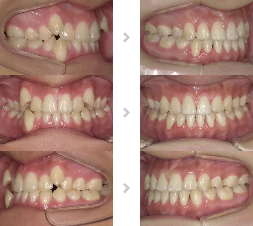 術前術後の比較
