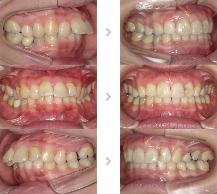 術前術後の比較