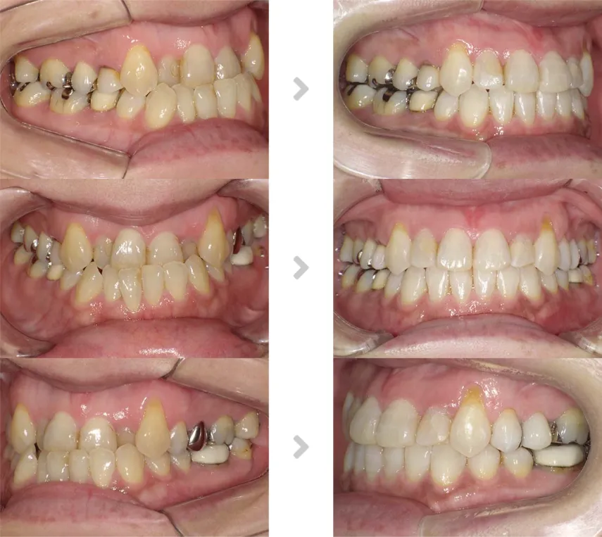 術前術後の比較