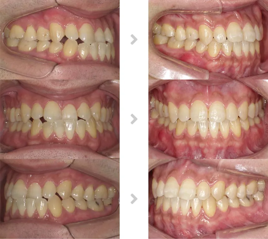 術前術後の比較