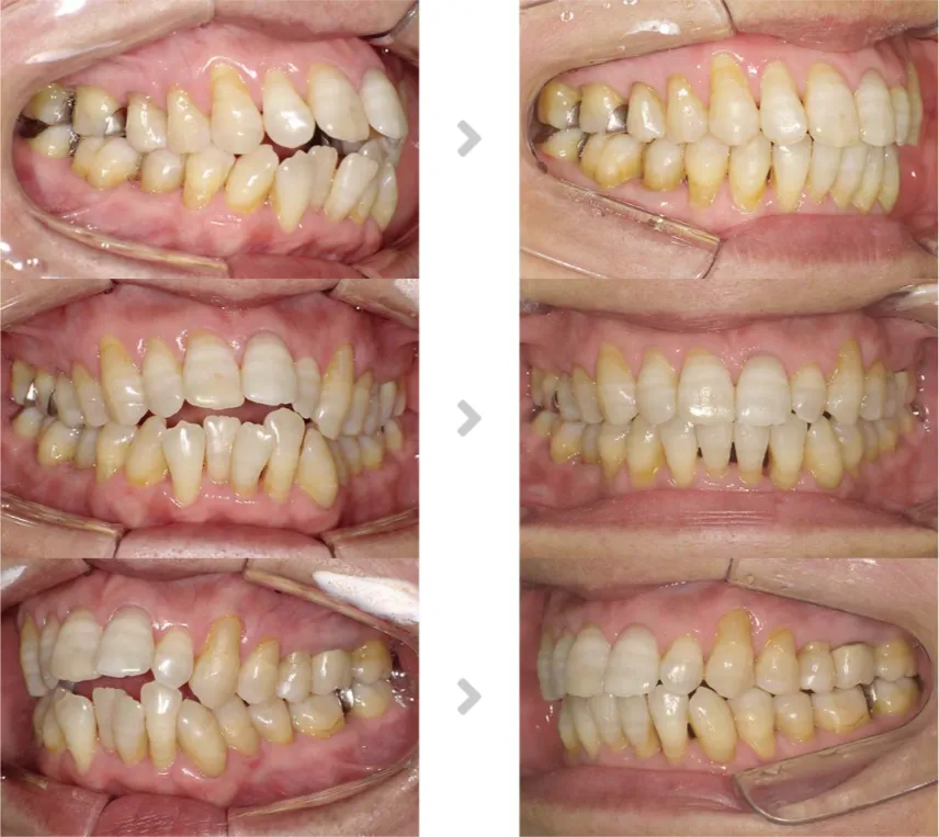 術前術後の比較