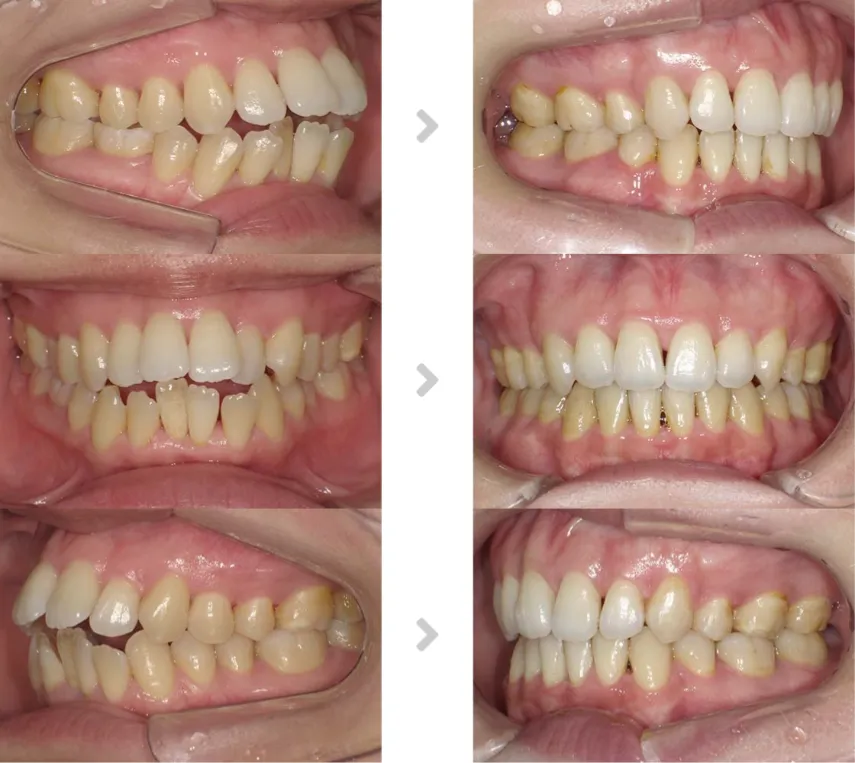 術前術後の比較