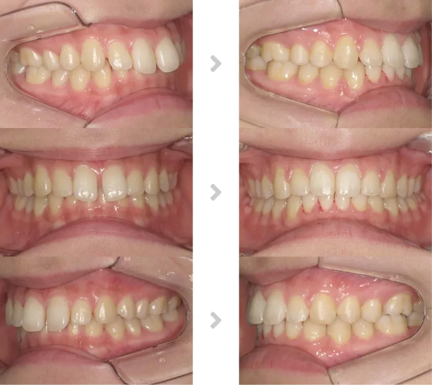 術前術後の比較