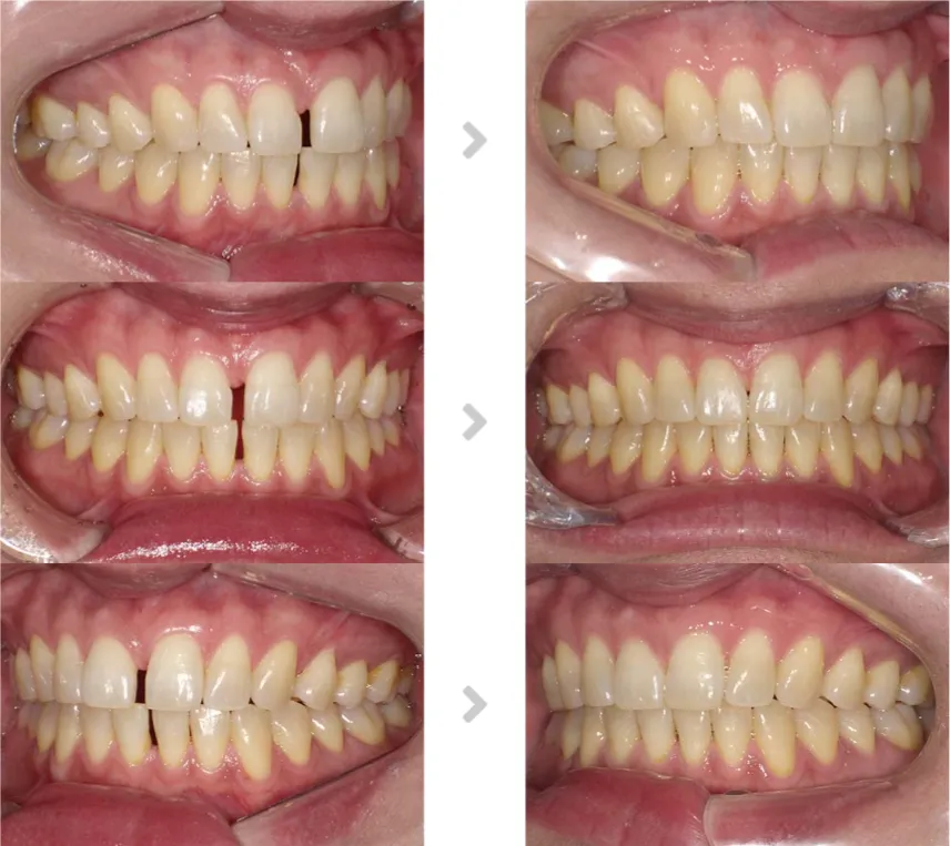 術前術後の比較