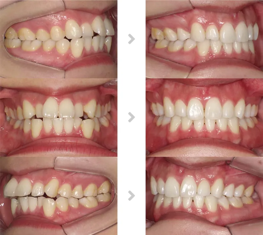 術前術後の比較