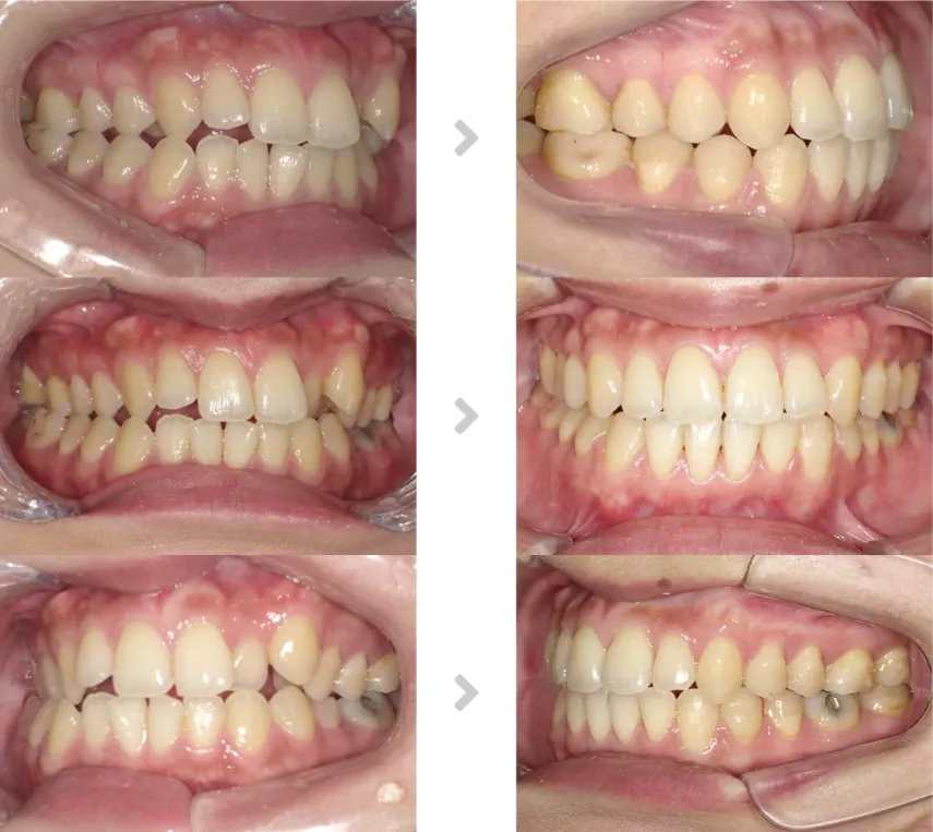 術前術後の比較