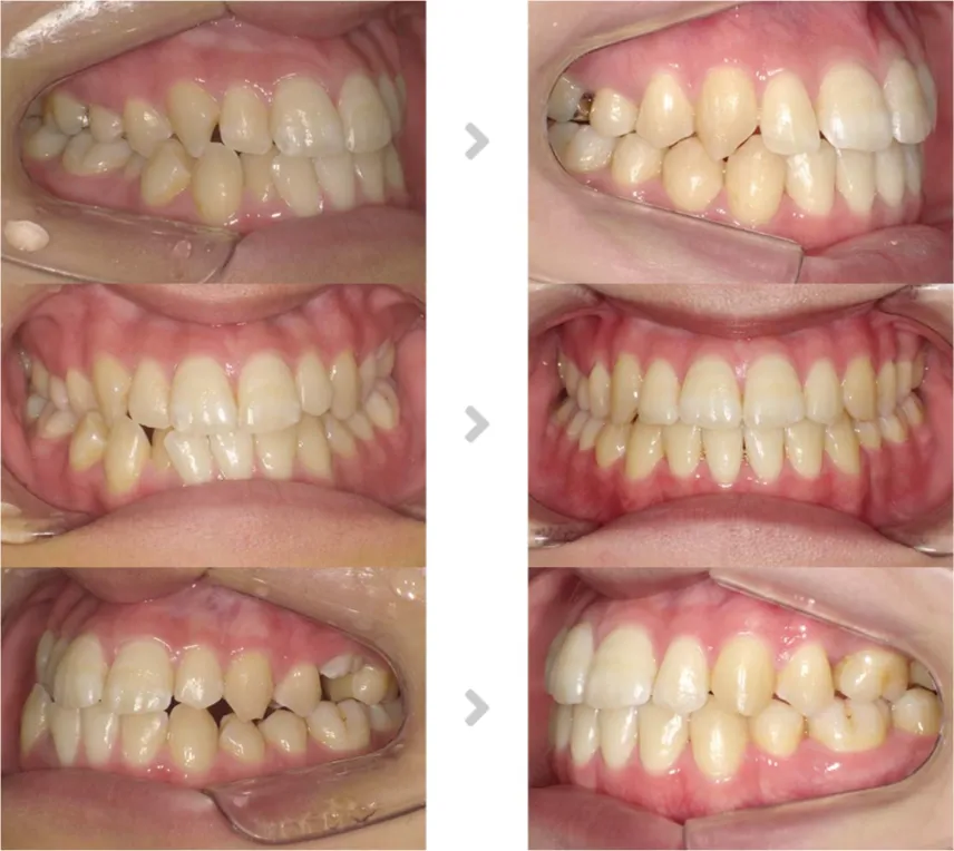 術前術後の比較