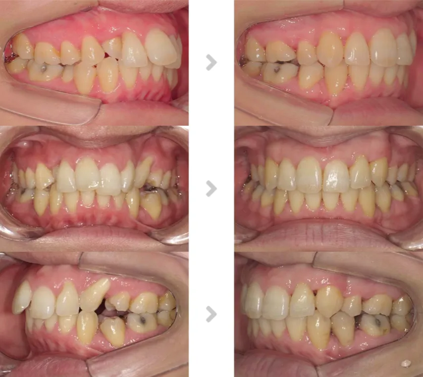 術前術後の比較