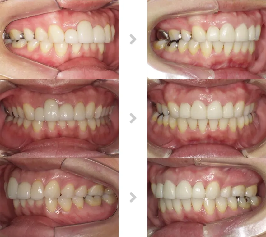 術前術後の比較