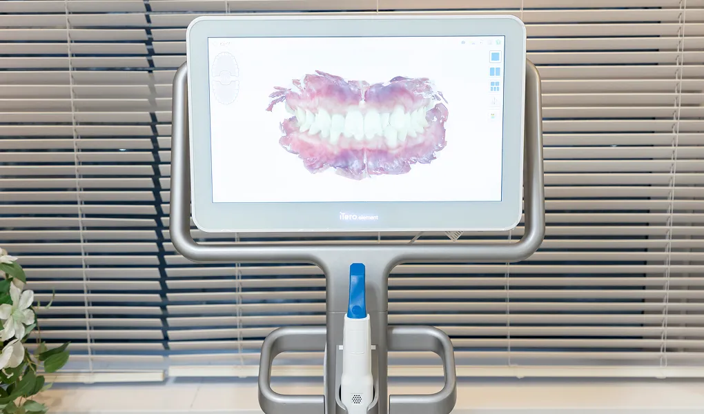 口腔内スキャナー（iTero）