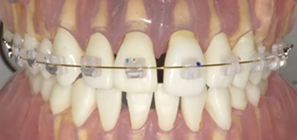 レモンゴールド