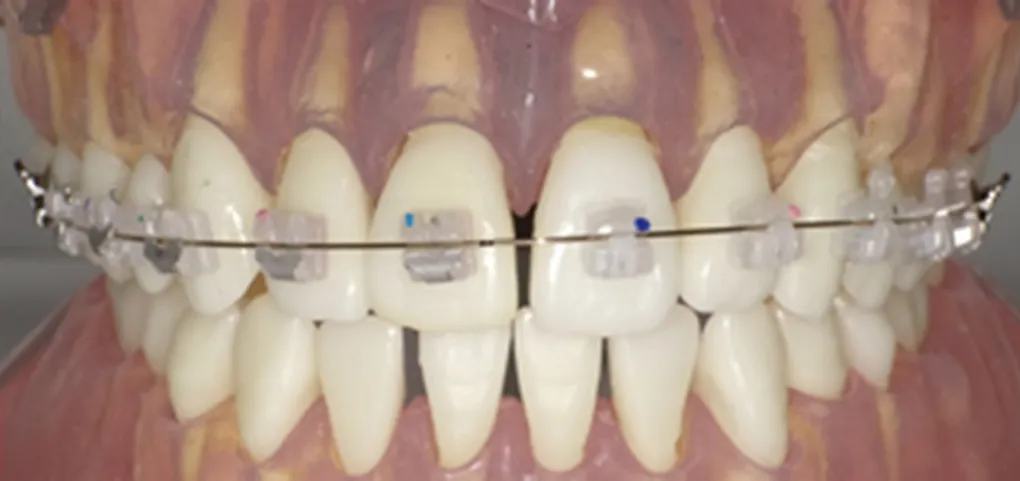 ピーチゴールド ※おすすめ!