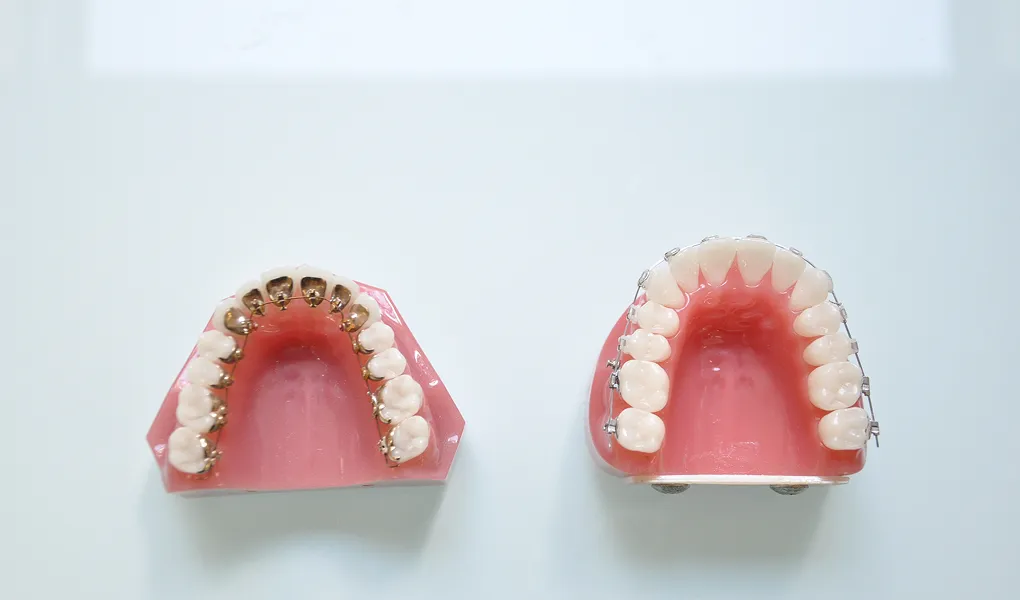 ハーフリンガル