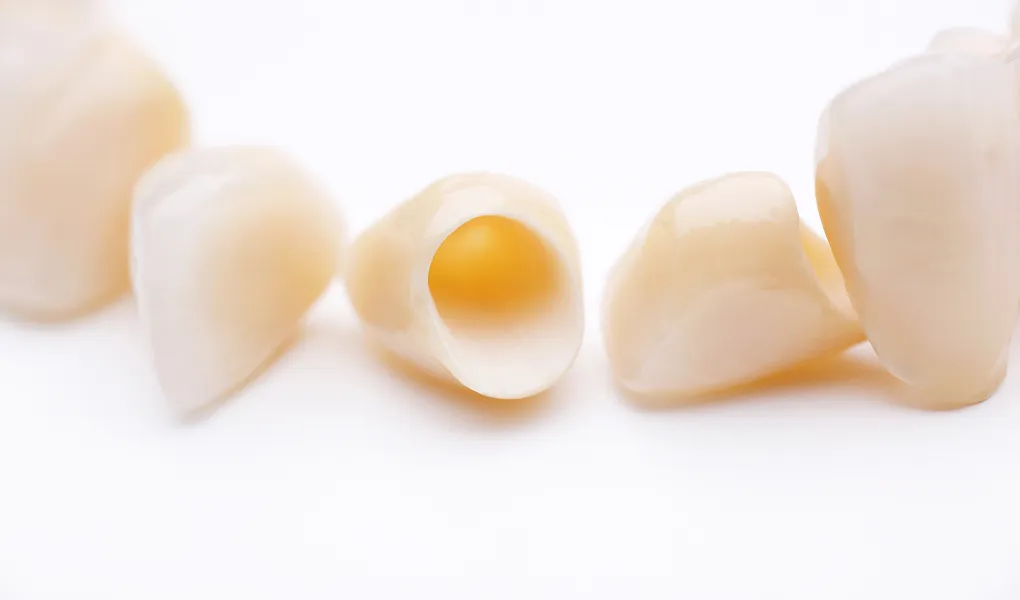 セラミックについて