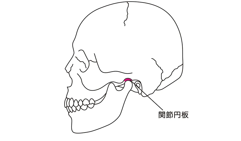顎関節症の主な症状