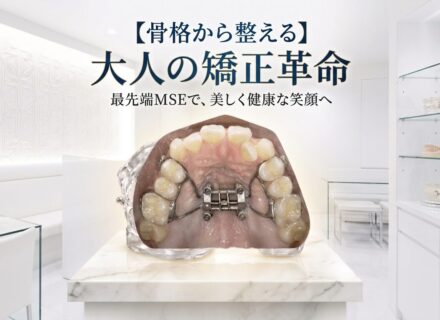 【大人の矯正】あきらめていた骨格のズレ・顔の非対称を「手術なし」で改善する最新装置「MSE」の秘密
